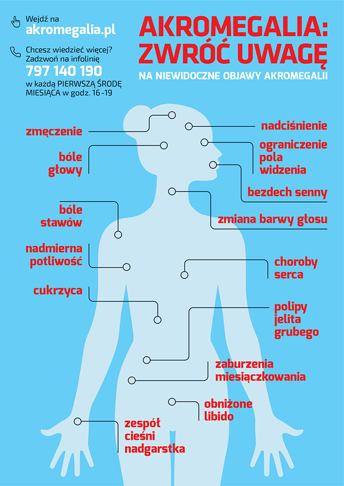 Akromegalia: jak rozpoznać chorobę?